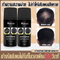 ราคา ผงใส่ผม ผงไฟเบอร์ปิดผมบาง ผงไฟเบอร์ใส่ผม สเปรย์ผมไฟเบอร์ ผงไฟเบอร์โรยผม ผงปิดผมบาง ผมบาง แก้ปัญหาหัวล้าน (25735632734)
