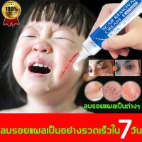 ราคา ครีมลดรอยแผลเป็น ครีมทาแผลเป็น ครีมแผลเป็น 30mlแผลไฟไหม้ ครีมลบแผลเป็น ครีมรักษาแผลเป็น ครีมกำจัดรอยแผลเป็น น้ำร้อนลวก (26184426670)