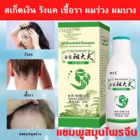 ราคา ส่งจากไทย แชมพูสมุนไพร Zudaifu แชมพูสระผมขจัดรังแค ลดผมร่วง เชื้อราบนหนังศรีษะ สะเก็ดเงิน บำรุงเส้นผมและหนังศรีษะ (19325249969)
