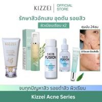 ราคา Kizzei Acne Series ผลิตภัณฑ์ดูแลสิว โฟมสิว โทนเนอร์ เซรั่มแต้มสิว ครีมลดสิว ผลัดเซลล์ผิว ลดสิวอุดตัน สิวอักเสบ หน้าใส (3491850307)