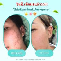 ราคา สบู่กลูต้าคอลลาเจนแครอท หน้าสวยขาวใส ไร้สิว (29952201722)