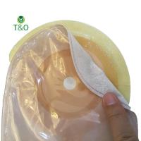 ราคา T&O 20 ชิ้น/เซ็ต Ostomy Care Fix เทป Spunked เทป Colosstomy กระเป๋า Poets Ostomy Aids (55105295462)