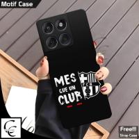 ราคา Softcase Motorola Edge 60 Fusion 5G & Motorola Edge 60 Pro 5G ล่าสุด 2026 ยืดหยุ่น HP เคสป้องกันน่ารัก Cool HP Case Motorola (43028478460)