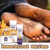 ราคา Aichun Foot Cream Dead Skin Remover Foot Crack Cream ครีมส้นเท้าแตก Foot Care 100ml (28488242822)