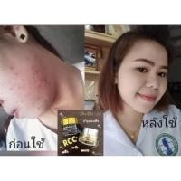 ราคา RCC ไนท์ครีม รักษาสิว ฝ้า กระ (8412391557)