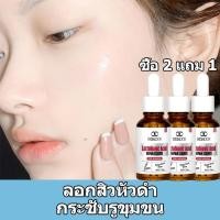 ราคา เซรั่ม หน้าใส เซรั่มดูแลหลุมสิว สูตรเกาหลี ไนอะซินาไมด์ 20% ลด สิว ฝ้า ขาวใส ลดริ้วรอย กระชับรูขุมขน แก้ปัญหาสิวอุดตัน (28177523687)