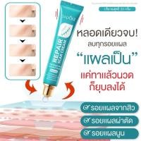ราคา ครีมแผลเป็น 20g แผลคีลอยด์ รอยแผลเป็น ครีมทาแผลผ่าคลอด ลดแผลไฟไหม้ รอยสิว แผลผ่าตัด (41602038593)