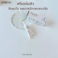 ราคา EVE'S อีฟส์ แอนตี้ แอคเน่ ครีม ครีมแต้มสิว ลดสิวอักเสบ สิวอุดตัน สิวผด ช่วยสิวยุบ แห้งไว (24490257424)