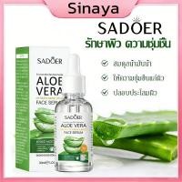 ราคา เอสเซ้นส์ สารสกัดว่านหางจระเข้ ผิวเรียบเนียน เซรั่ม ว่านหางจระเข้ Sadoer Aloe Vera Essence 30ml(880) (25747993611)