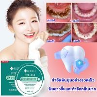 ราคา สูตรใหม่ที่ฟอกฟันยาสีฟันฟันขาว ลดกลิ่นปาก ยาสีฟันฟอกฟัน ลบคราบฟัน ฟันเหลือง ยาฟอกฟันขาว ป้องกันฟันผุ ยาฟอกสีฟัน (26601815306)