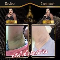 ราคา ตรีชฎา เซรั่มรักแร้ (Treechada Extra Body Serum) (13392042794)
