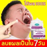 ราคา ครีมทาแผลเป็น ครีมแก้ขาลาย ลบรอยแผลเปน ลดรอยเเผลเป็น เหมาะสำหรับผิวรอยแตกลาย น้ำร้อนลวก แผลผ่าตัด แผลเป็นจากยุงกัด ยาแก (28205339468)