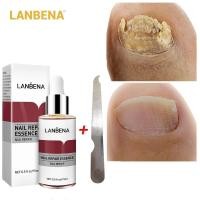 ราคา LANBENA Nail Repair Essence Serum Fungal Nail Treatment 12ml (41127376812)