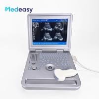ราคา New Medical 12 Inch Portable White and Black Ultrasound Scanner Device Ultrasonic Machine System wi (45407135837)