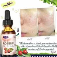 ราคา Life Flo Health, Pure Rosehip Seed Oil, Skin Care, 1 oz (30 ml) (1958671899)