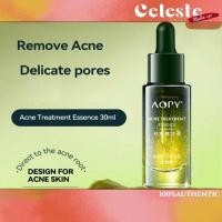 ราคา Aopy Acne Removal Essence Salicylic Acid Anti-acne Lighten Acne Scars Acne Removal Drying Lotion ของแท้ 100% (29818650766)