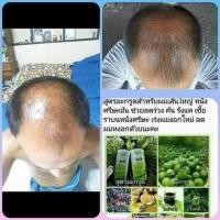 ราคา แชมพู 4YLลดผมร่วง กระตุ้นผมขึ้นใหม่ (8700071713)