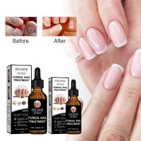 ราคา เล็บซ่อมของเหลวหนา Brightening Removing Onychomycosis Repairing Moisturizing Nail Care เล็บ Nutrition Care Liquid (40908132655)