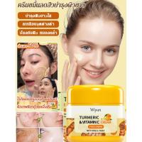 ราคา 【เห็นผลภายใน 7 วัน ลดรอยสิว หน้าขาวใส】ครีมขมิ้น SL ดูแลปัญหาสิวครบวงจร ฟื้นบำรุงผิวขาวเนียนนุ่ม / Acne Cream / Brightening Cream / Turmeric Skincare / Oil Control Face Cream (55955407174)