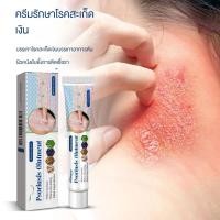 ราคา ขายร้อน✨South Moon ครีมลดอาการคัน ครีมแก้คันผิวหนัง ครีมบำรุงผิว สมุนไพร แก้คันเรื้อรัง สำหรับทาภายนอก (47557408886)