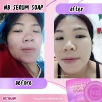 ราคา สบู่หน้าใส ลดสิว กระชับรูขุมขน NB saop (21713928030)