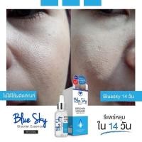 ราคา ส่งฟรี⚡️ถูก}แท้บลูสกาย เซรั่มเรียกหลุมสิว #มาดามกิ๊กกี้ (18744401880)