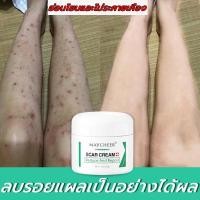 ราคา 【มีสินค้าพร้อมจัดส่ง】ALIVER 50ml ครีมลดรอยแผลเป็น แผลเป็น ลดเลือนแผลผ่าตัดการคลอด แผลผ่าตัด แผลเป็นใหม่และแผลเป็นเก่า (29626759795)