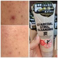 ราคา โฟมล้างหน้าญี่ปุ่น ลดสิว detox chacoal scrub cleansing ผิวกระจ่างใส (17838722231)