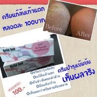 ราคา ครีมทาส้นเท้าแตก ครีมเท้านุ่ม นุ๊ม (102284712)