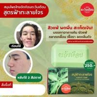 ราคา ฟ้าทะลายโจร ช่วย สิวแพ้ ผดผื่น คัน กลากเกลื้อน เชื้อรา กลิ่นตัว สบู่สมุนไพรฟ้าทะลายโจร (17696443109)