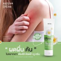 ราคา [1แถม1] ครีมอัลตร้ายู แก้ ภูมิแพ้ผิวหนัง ผื่น ตุ่มคัน คัน แพ้ ลมพิษ ผิวแพ้ง่าย ผื่นคันรังแค เซ็บเดิร์ม ผื่นคันขุยขาว (24158918097)