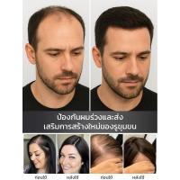 ราคา 【สเปรย์เดียวผมร่วงลดลง】สเปรย์ปลูกผมดูแลหนังศีรษะ ป้องกันผมร่วง เซรั่มบำรุงผม/เซรั่มปลูกผม/แก้ปัญหาหัวล้าน/ปลูกผมผู้ชาย/ฟื้นฟูรากผม (42326201741)