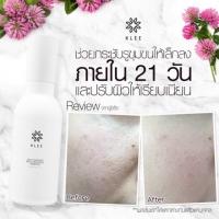 ราคา KLEE Essence น้ำตบEssence น้ำตบที่หลายคนใช้แล้วบอกต่อพร้อมการันตีคุณภาพ ✨✨ (965952176)