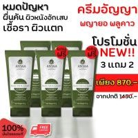 ราคา ครีมรักษาผิวหนัง ลดรอยแดง กลากเกลื้อน ผิวหนังอักเสบ รักษาโรคผิวหนัง น้ำเหลืองไม่ดีคัน ลดอักเสบ ครีมอัญญา (3 แถม 2) (17792635929)