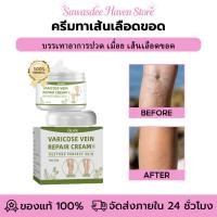 ราคา EELHOE เส้นเลือดขอด ครีมทาเส้นเลือดขอด บรรเทาอาการปวด เมื่อย เส้นเลือดขอด ปรับปรุงการไหลเวียนโลหิต Varicose Cream (25346403154)