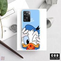 ราคา HP Oppo A57 2020/A77S - เคสโทรศัพท์ - เคสโทรศัพท์ - Softcase Oppo A57 2020/A77S Phone Case - เคสโทรศัพท์ - Softcase - Oppo A57 2020/A77S เคสโทรศัพท์ - เคสโทรศัพท์ - Softcase A57 2020 (49460145492)