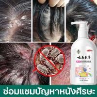 ราคา แชมพูป้องกันเหา99%แชมพูกำจัดเหา กำจัดเหา กำจัดต้นตอ กำจัดเหา ปลอดภัย ไม่ระคายเคือง แชมพูออร์แกนิก กำจัดเหาถาวร (28614369093)