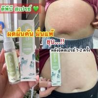 ราคา DPBสเปรย์รักษาโรคผิวหนังโรคสะเก็ดเงินเชื้อราทุกชนิดโปรโมชั่น3ขวดสุดคุ้ม 580฿ (10897387798)