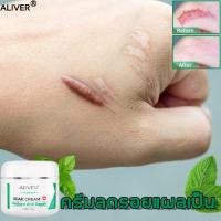 ราคา 【การส่งมอบกรุงเทพฯ】 ครีมกำจัดรอยแผลเป็น 50ml ครีมลบรอยแผลเป็น ครีมลดรอยสิว แผลไฟไหม้/น้ำร้อนลวก ครีมลดแผลเป็น ลบรอยแผลเปน ครีมลบแผลเป็น (20479017655)