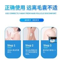 ราคา พร้อมสต็อกจัดส่งด่วน Old Five Shop Hair Follicle Cleanser Cream ผู้ชายผู้หญิง Scalp Care (Non-Back Acne Cuticle Hair Follicle Blockage Anti-Itch Cream)2655987226 (55514854072)