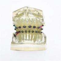ราคา Dental Orthodontic Teeth Model Transparent Teeth Malocclusion Orthodontic Model With Brackets (22185062537)