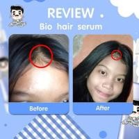 ราคา bio hair serumของแท้ (5455613186)