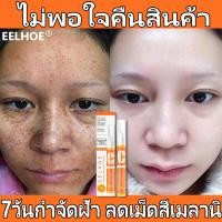 ราคา ครีมทาฝ้า ครีม แก้ ฝ้า กระ eelhoe ทาฝ้าของแท้ ครีมทาฝ้าหนาๆๆ ครีมแก้ฝ้าหนาๆ vitamin c ครีมแก้ฝ้าถาวร ครีมกำจัดฝ้าวิตามิน (18979656168)
