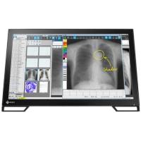 ราคา Monitor EIZO RadiForce MS236WT-A