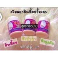 ราคา ขาย Acne ครีมลอกสิวเสี้ยน สูตรเวียดนาม ขั้นเทพ (326205)