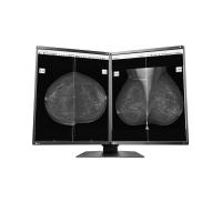 ราคา EIZO RadiForce GX560-MD 21.3 INCH IPS MAMMODUO *จอคอมพิวเตอร์ (GX560-MD)