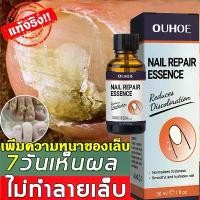 ราคา (การดูแลเล็บ) OUHOE Nail Care Essence 30ml Ingrown Toenail Onychomycosis Nail Repair Essence Soft Nail Thickening Nail Smoothing สเปรย์ฉีดเล็บขบ ยาทาเชื้อราเล็บ (1732209345554581316)