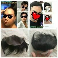 ราคา exhilarateshop ปัจจุบัน วิกติดกาวผู้ชายผมแท้ วิกปิดหัวเถิก หัวล้านครึ่งหน้า หัวล้านตัวเอ็ม 15×7cm M-shaped Forehead Toupee (1731792795841628264)