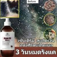 ราคา ขาย ร้อน แชมพูแก้คัน ยาสระผมขจัดรังแค แชมพูรังแค 500ml ขจัดรังแค แก้คัน กำจัดไร รักษาเซบเดิร์ม ลดผมร่วง แก้รังแค แชมพู ผมมัน (1731995616436848318)