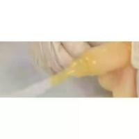 ราคา พร้อมส่ง. พร้อมส่งถุงปัสสาวะ คอนดอม 35 มม. (6-10 ชิ้น) DURA External Catheterถุงปัสสาวะคอนดอม(ดูร่า) ถุงยางอนามัยต่อสายปัสสาวะCondom External Catheter พร้อมสายรัด (1732166386637178054)
